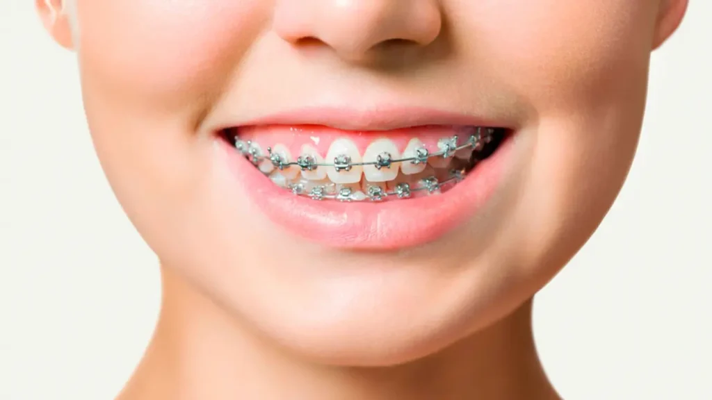Irygator jamy ustnej i opieka ortodontyczna