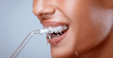 Dlaczego warto używać irygatora dentystycznego do czyszczenia aparatów ortodontycznych?